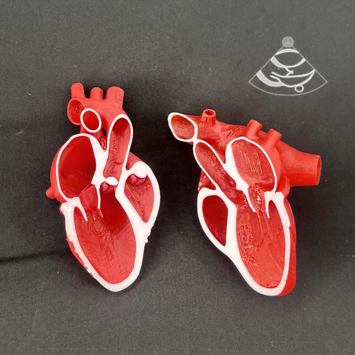 Parasternal Long Axis